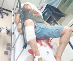 Se fractura las piernas