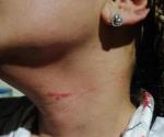 Rescatan a mujer de su esposo golpeador