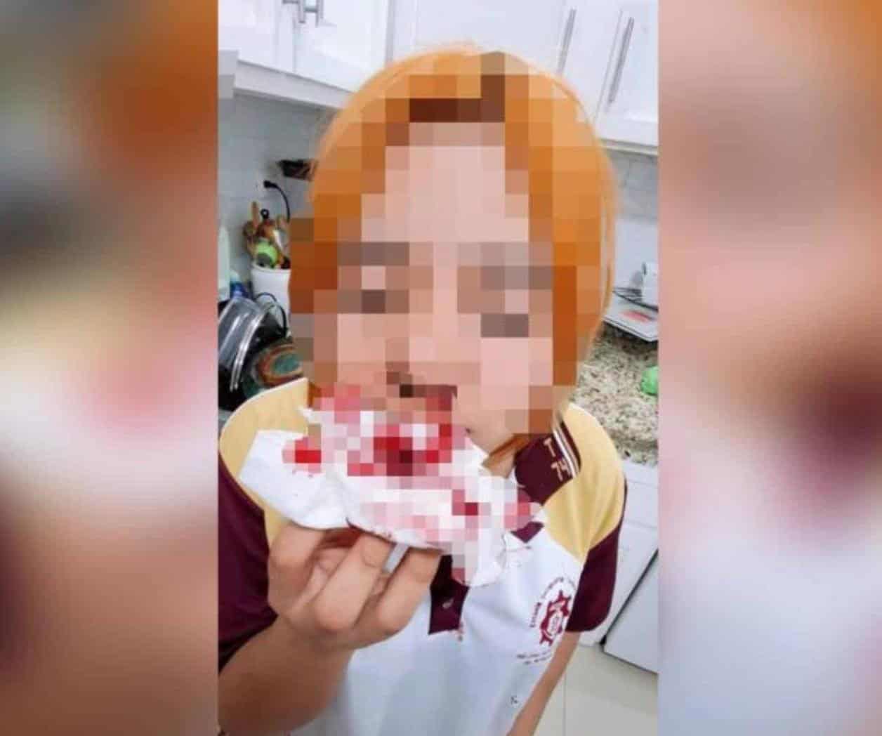 Prende alertas ataque contra una estudiante