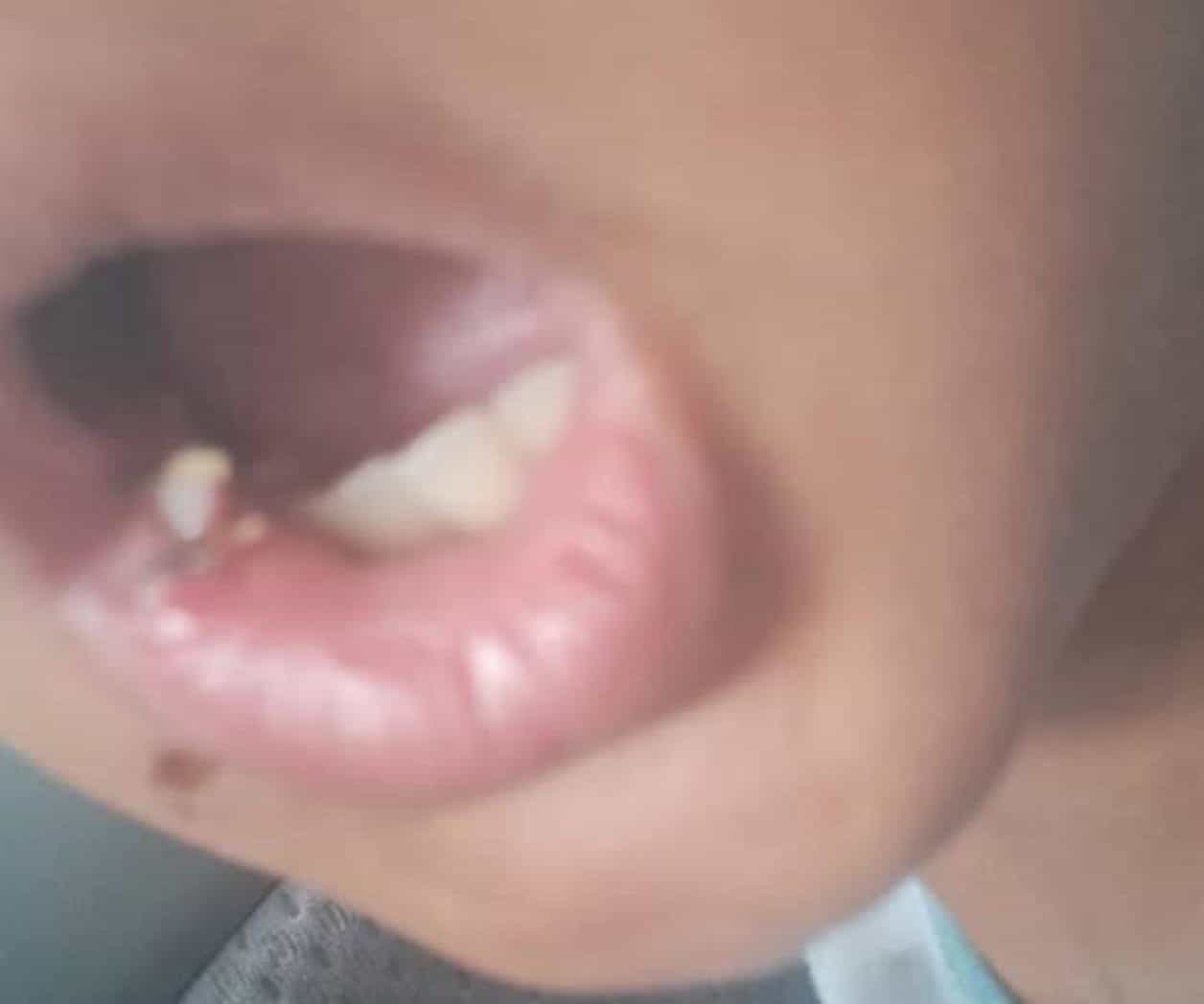 Denuncian caso de negligencia en primaria