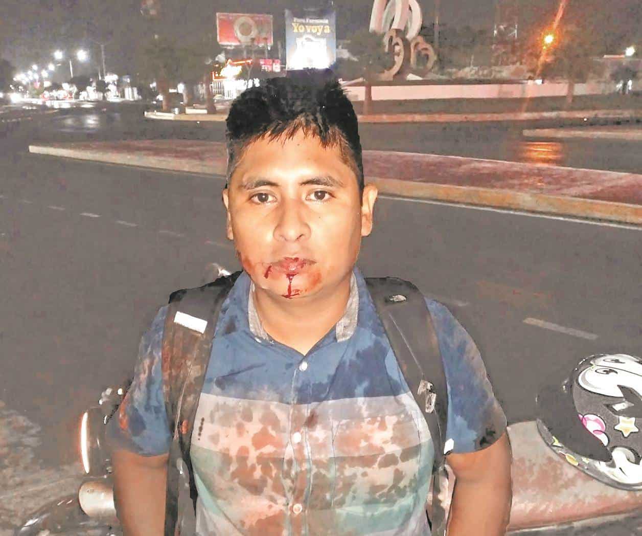 Viene a fiesta, termina herido
