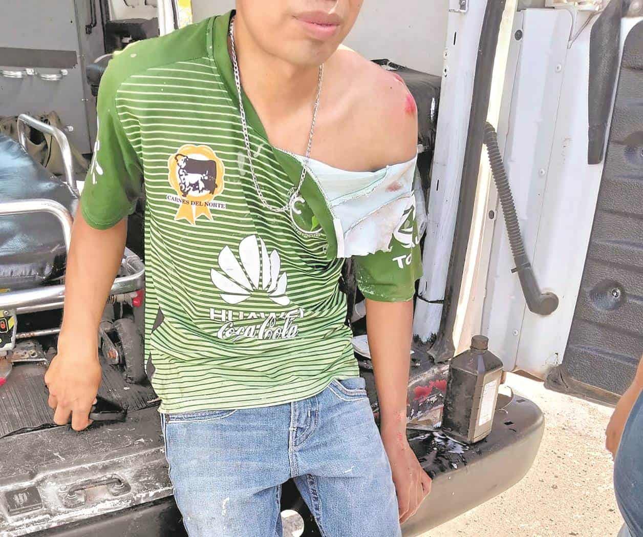 Arrollan a joven motociclista en la 120 con 82