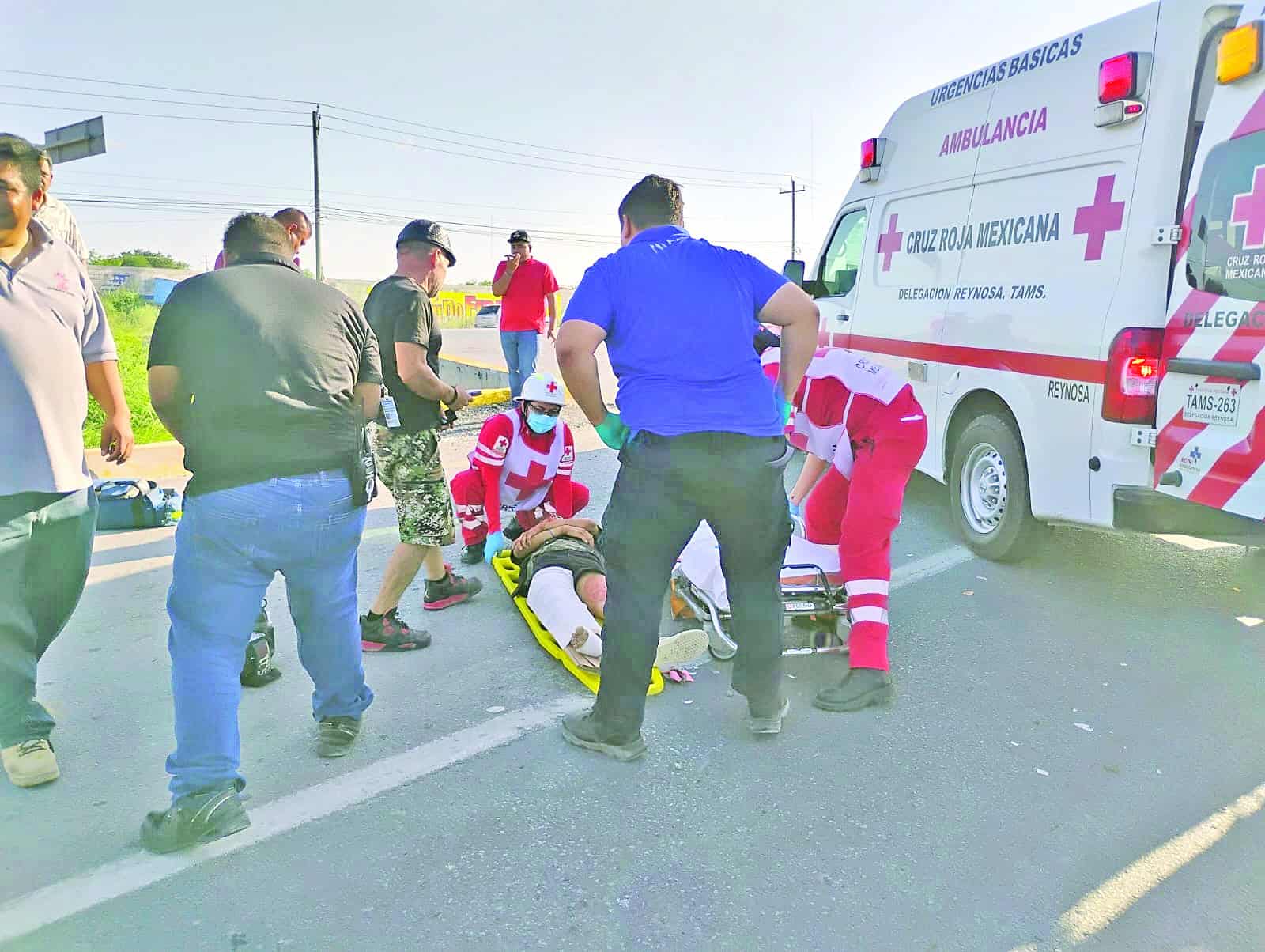 Sufre atropello y queda con fractura expuesta