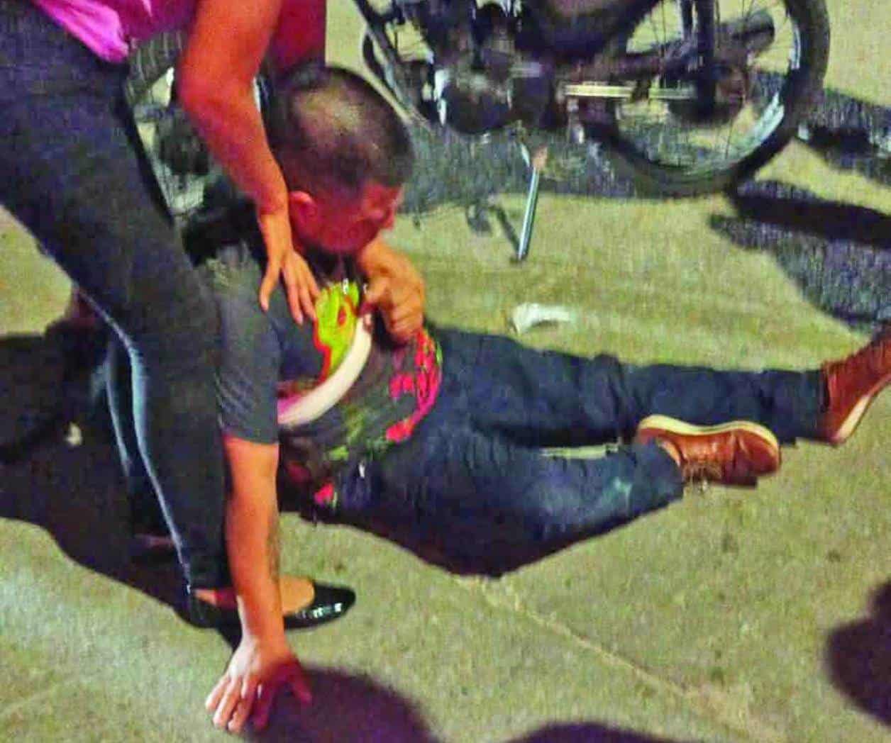 Ebrio cae de su moto y se fractura la clavícula 