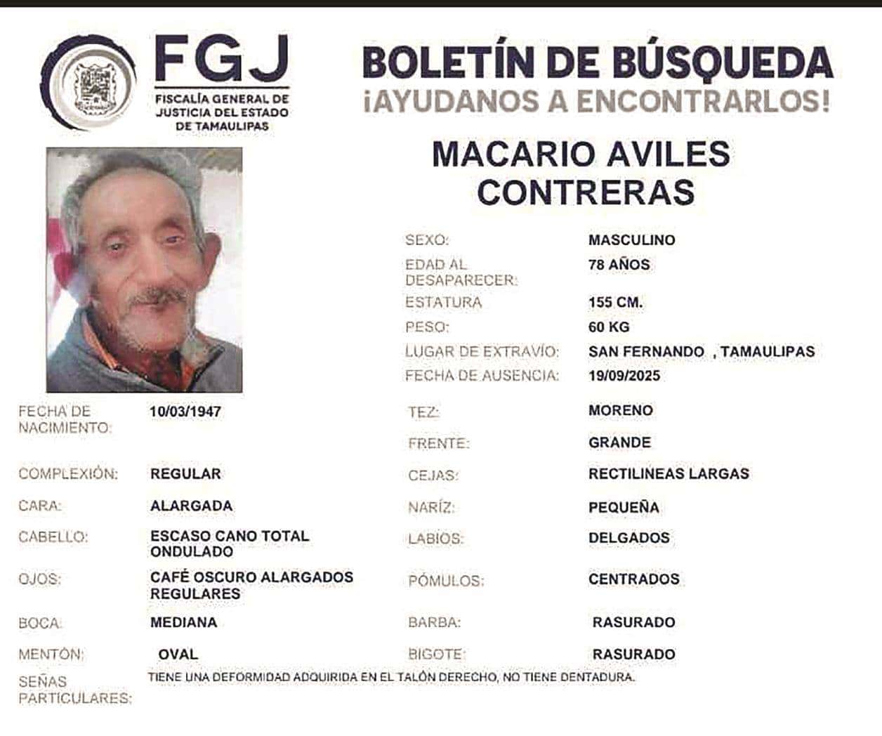 Reportan la desaparición de abuelito